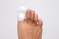 The Differences Between a Sprained Toe and a Broken Toe