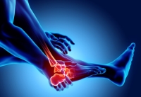 The Feet Can Develop Various Forms of Arthritis