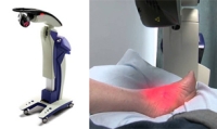 Shockwave Therapy and Plantar Fasciitis