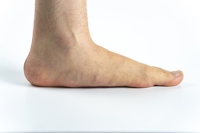 Existing Medical Problems May Lead To Flat Feet